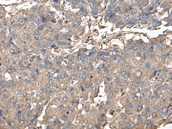 Polyclonal Rabbit anti-Human PLDN / Pallidin Antibody (IHC, WB)