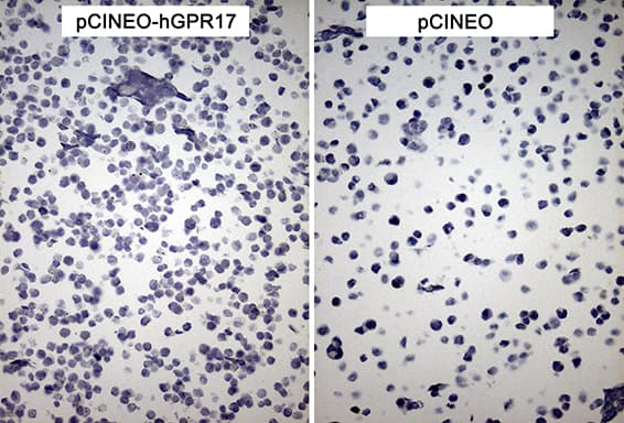 Monoclonal Mouse anti-Human GPR17 Antibody (clone OTI6E2, IHC)