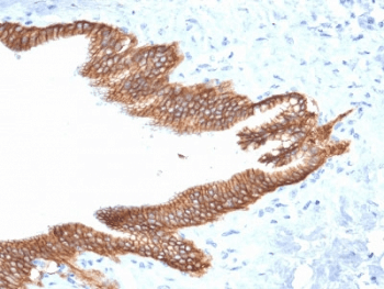 Monoclonal Mouse anti-Human TROP2 / TACSTD2 Antibody (clone TACSTD2/2152, IHC, WB)