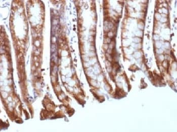 Monoclonal Mouse anti-Human CTNNB1 / Beta Catenin Antibody (clone CTNNB1/1508, IHC, IF, WB)