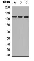 Polyclonal Rabbit anti-Human ITGA2B / CD41 Antibody (N-Terminus, WB)