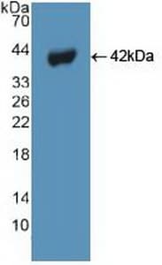 BECN1 / Beclin-1 Antibody (aa1-273)