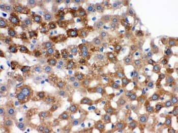 TF / Transferrin Antibody