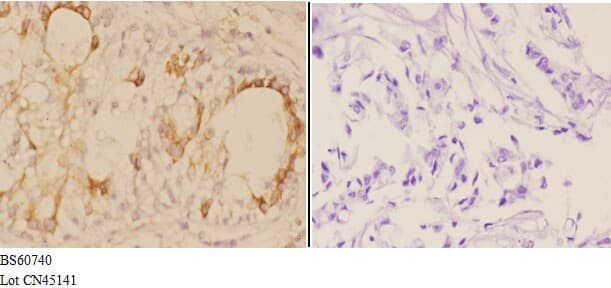 ADAM12 Antibody
