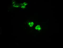 Monoclonal Mouse anti-Human GCK / Glucokinase Antibody (clone OTI3E3, IHC, IF, WB)