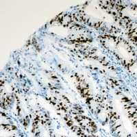 PITX1 Antibody (Internal)