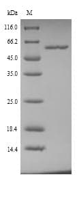 Mouse GPT / Alanine Transaminase Protein (Recombinant 6His, N-terminus)