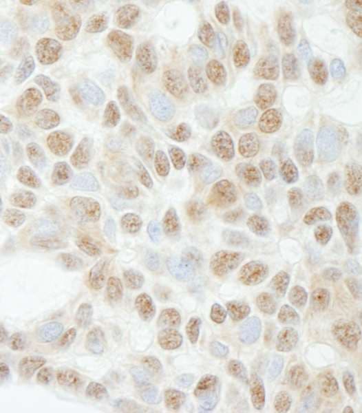 Polyclonal Rabbit anti-Human ADNP Antibody (aa1050-C-term, IHC, WB)