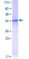 Human TNFAIP8 / SCC-S2 Protein (Recombinant GST)