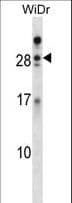 AZU1 / Azurocidin Antibody (aa67-96)