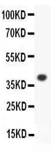 Polyclonal Rabbit anti-Human ALOX15 / 15-Lipoxygenase Antibody (aa2-337, IHC, WB)