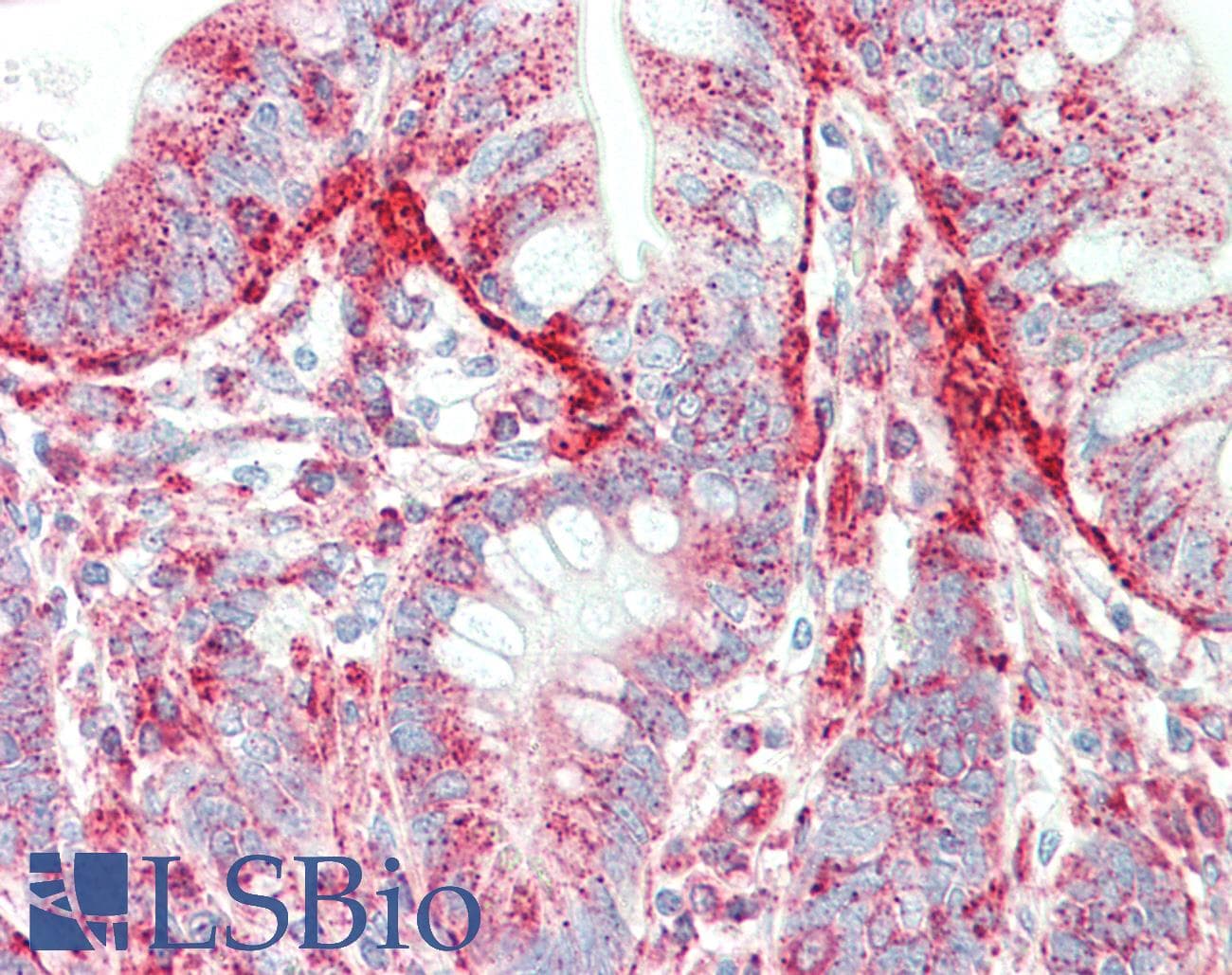 IHC-plus™ SIPA1 Antibody