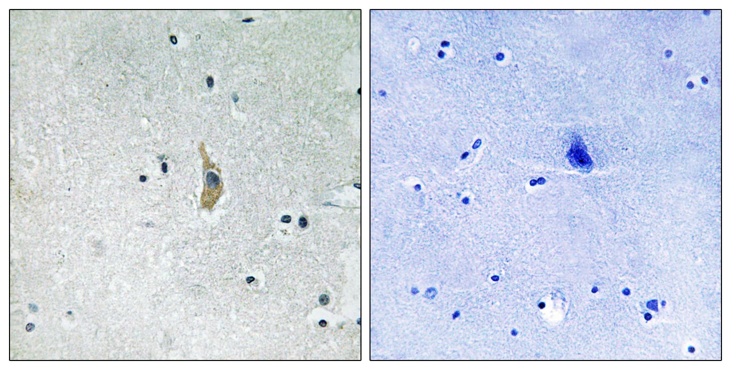PSEN1 / Presenilin 1 Antibody (aa323-372)