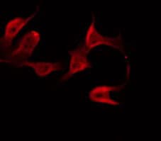 Polyclonal Rabbit anti-Human PDE4B+C+D Antibody (IHC, IF, WB)