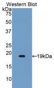 SERPINF2 / Alpha-2-Antiplasmin Antibody (aa340-491)