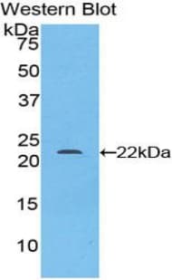 MAOA / Monoamine Oxidase Antibody (aa16-196, FITC)