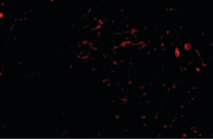 IHC-plus™ Polyclonal Rabbit anti-Human SIRT2 / Sirtuin 2 Antibody (IHC, IF, WB)