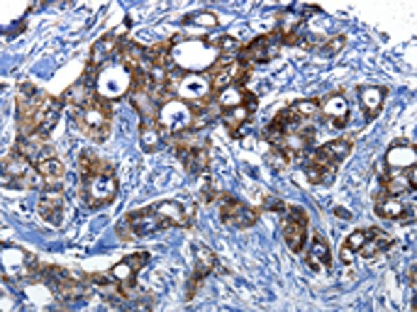 CASP1 / Caspase 1 Antibody