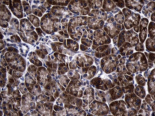 TINF2 Antibody (aa266-347, clone OTI2C12)