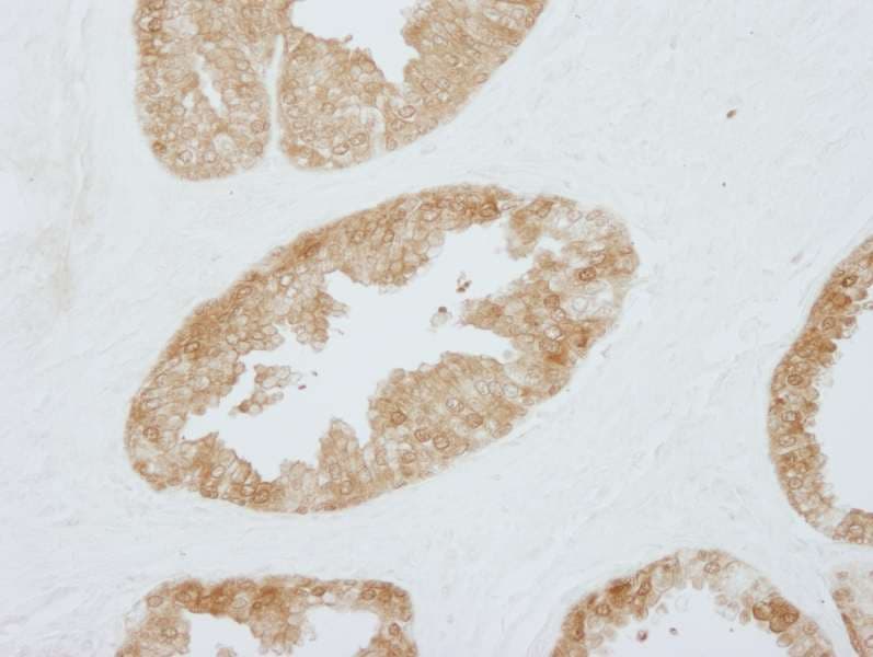 Polyclonal Rabbit anti-Human SFN / Stratifin / 14-3-3 Sigma Antibody (aa198-248, IHC, IF)