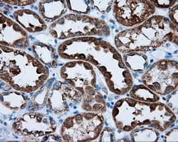 Monoclonal Mouse anti-Human RIP1 / RALBP1 Antibody (clone OTI2A6, IHC, IF, WB)
