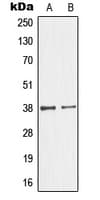 Polyclonal Rabbit anti-Human GIMAP4 Antibody (Internal, IHC, WB)