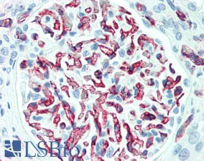 IHC-plus™ Monoclonal Mouse anti-Human PECAM-1 / CD31 Antibody (clone C31.3 + C31.7 + C31.10, Azide-free,BSA-free, IHC, IF, WB)