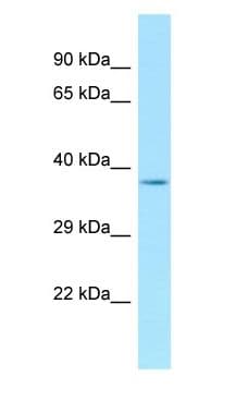 ANKRA2 / ANKRA Antibody (aa47-96)