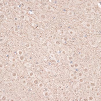 KDR / VEGFR2 / FLK1 Antibody
