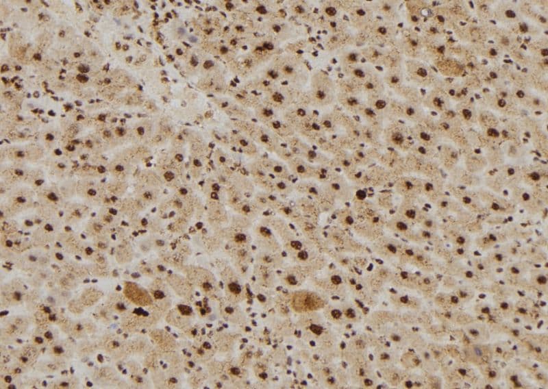 Polyclonal Rabbit anti-Human RAN Antibody (IHC, IF, WB)
