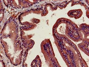 DPP4 / CD26 Antibody