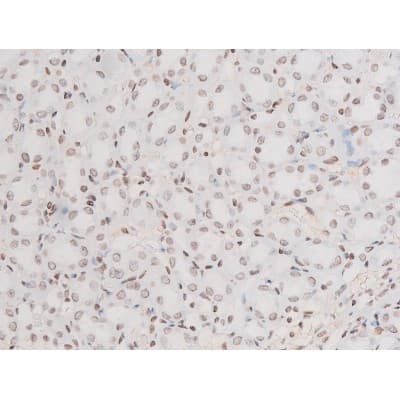 Polyclonal Rabbit anti-Human RELA / NFKB p65 Antibody (phospho-Thr435, IHC, IF, WB)