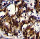 TRADD Antibody (aa126-151)