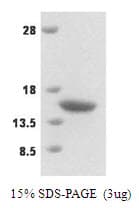 Human VAMP2 / VAMP-2 Protein (Recombinant His)