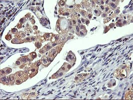 GSTO2 Antibody (clone OTI3A9)