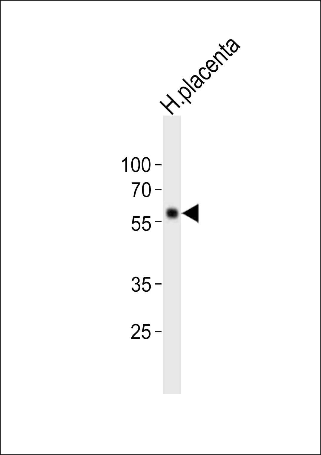 FOXO4 / AFX1 Antibody (aa415-450)