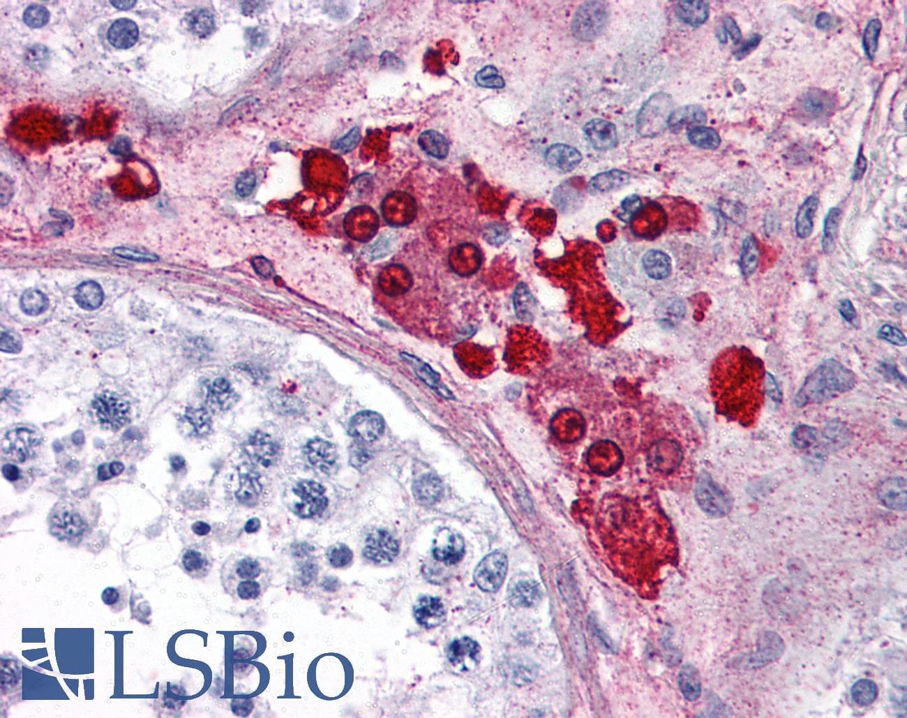 PathPlus™ ADORA2A/Adenosine A2A Receptor Antibody (C-Terminus)