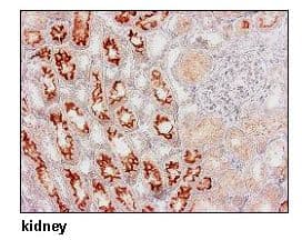 URAT1 / SLC22A12 Antibody