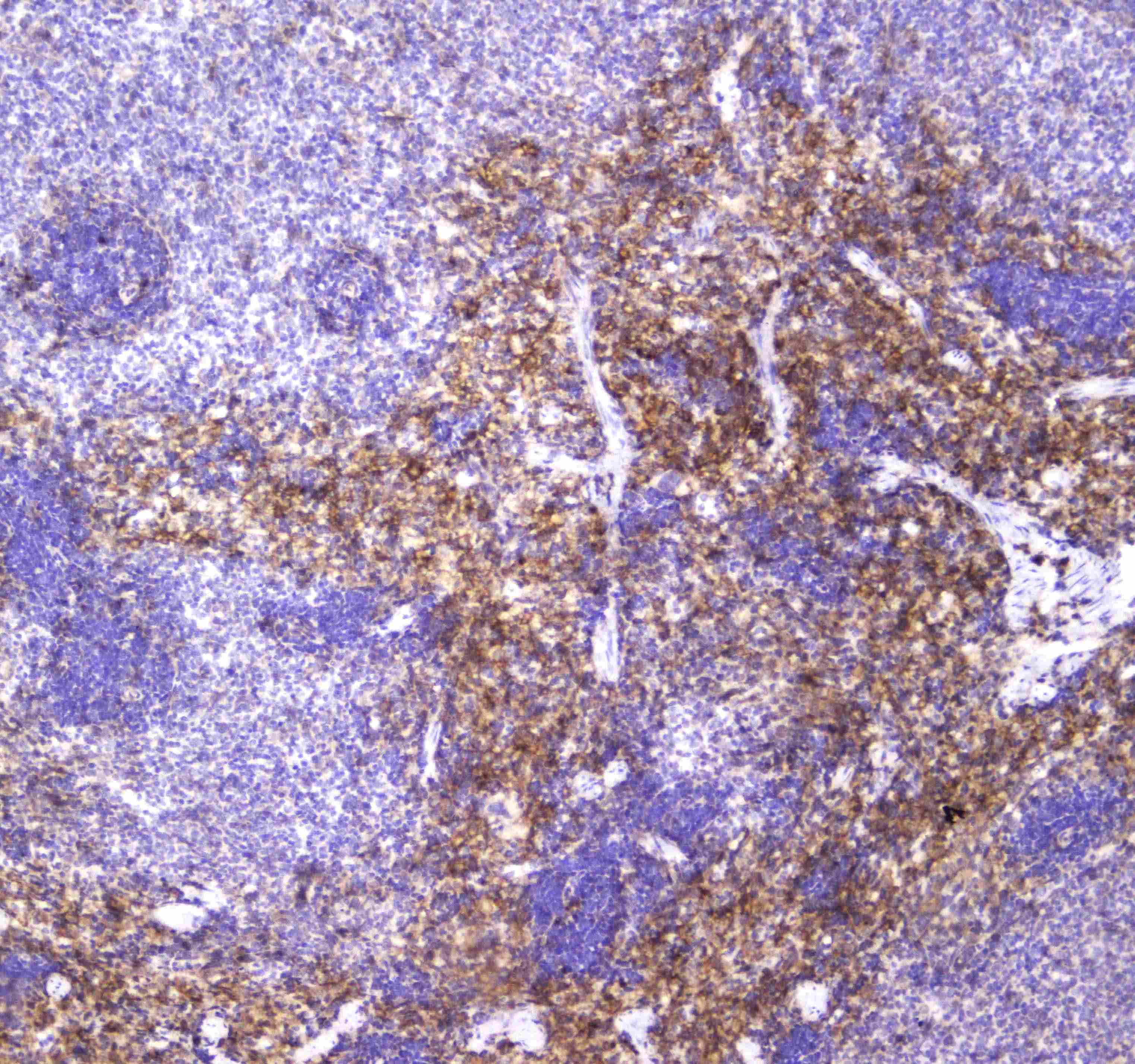 VCAM1 / CD106 Antibody