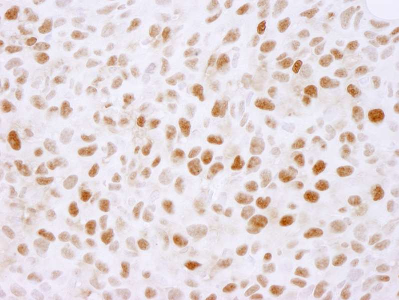 Polyclonal Rabbit anti-Human PLRG1 Antibody (aa464-514, IHC, IF)