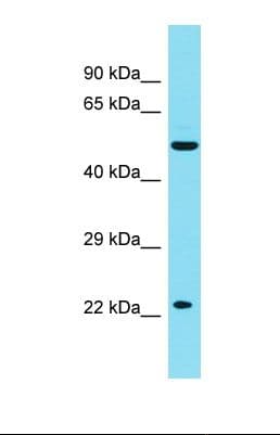 JADE2 / PHF15 Antibody (N-Terminus)