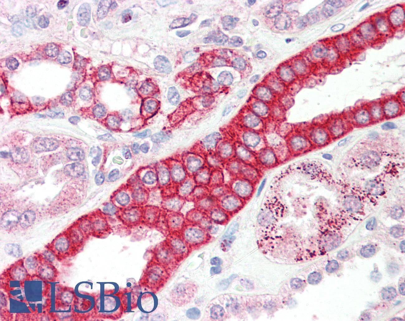 IHC-plus™ DCUN1D1 / SCCRO Antibody (aa248-258)