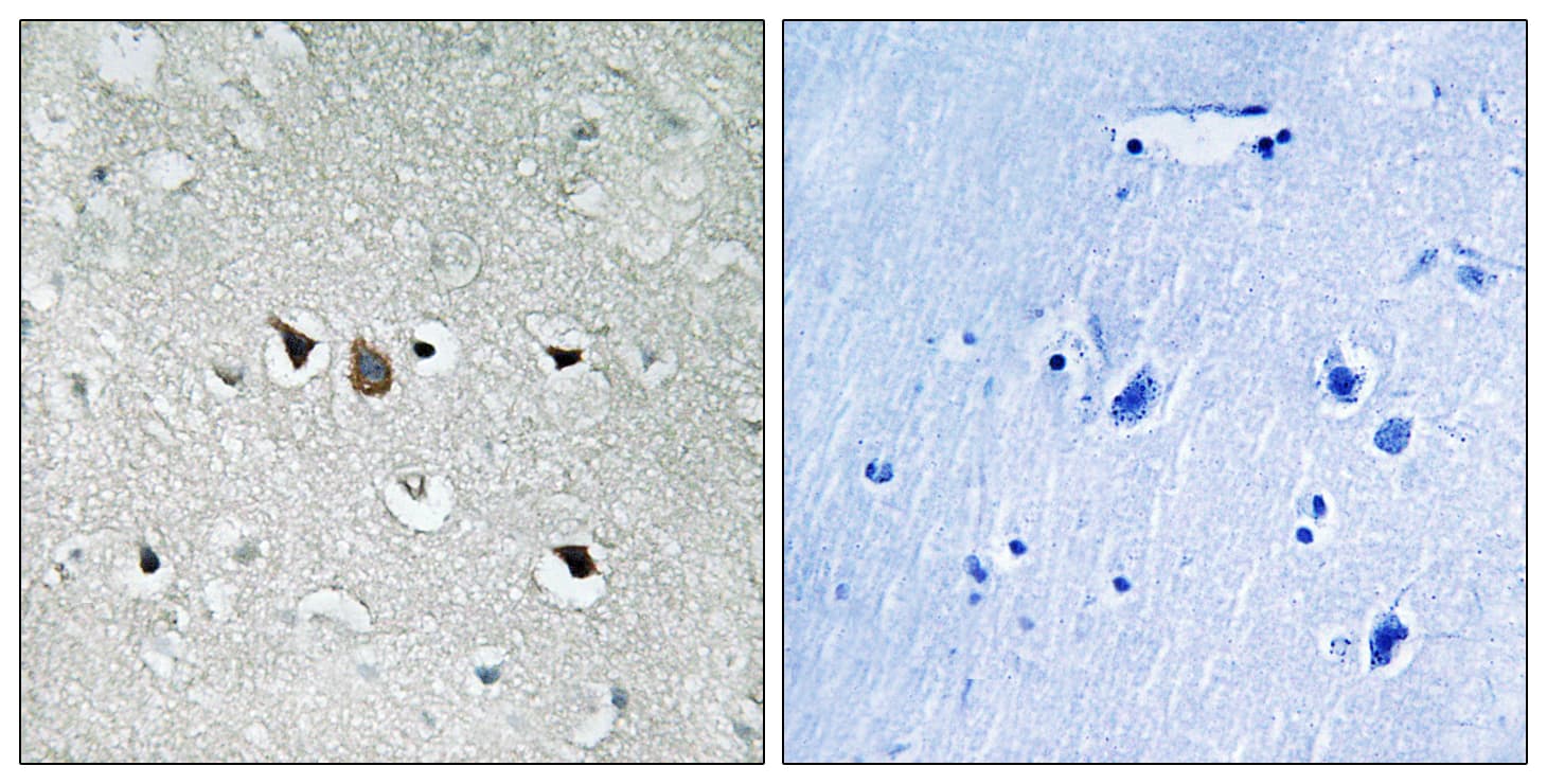 RAF1 / RAF Antibody (aa231-280)