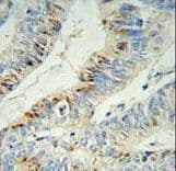 Polyclonal Rabbit anti-Human PHLPP2 / PHLPPL Antibody (aa1295-1323, IHC, WB)