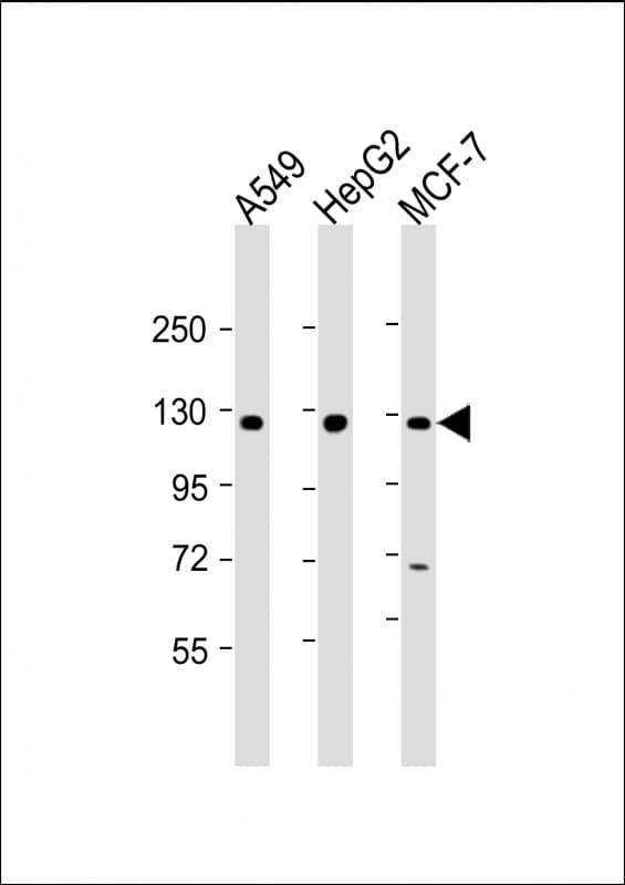 KLB / Beta Klotho Antibody (N-Terminus)