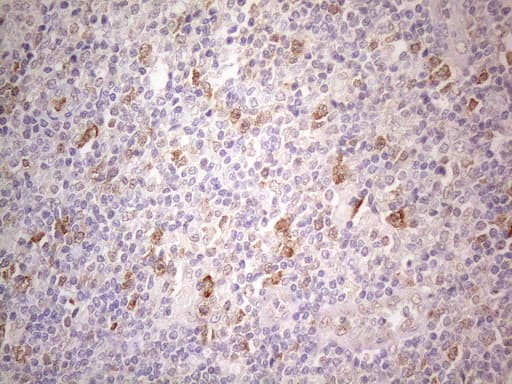 TNFSF5IP1 / CLAST3 Antibody (clone OTI1A1)