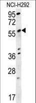 Polyclonal Rabbit anti-Human SPATA18 / MIEAP Antibody (aa92-120, IHC, WB)