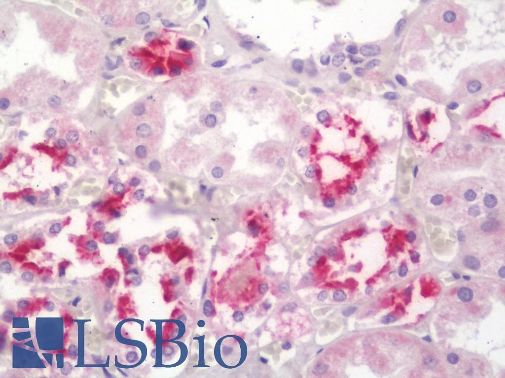 IHC-plus™ Polyclonal Rabbit anti-Human EMA / MUC1 Antibody (aa1176-1205, IHC, WB)