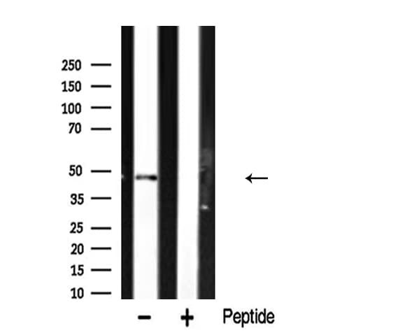 Polyclonal Rabbit anti-Human HNRNPH1 / hnRNP H Antibody (IF, WB)