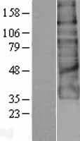 ADGRG1 / GPR56 Protein (Over-Expression Lysate Myc-DDK (Flag))